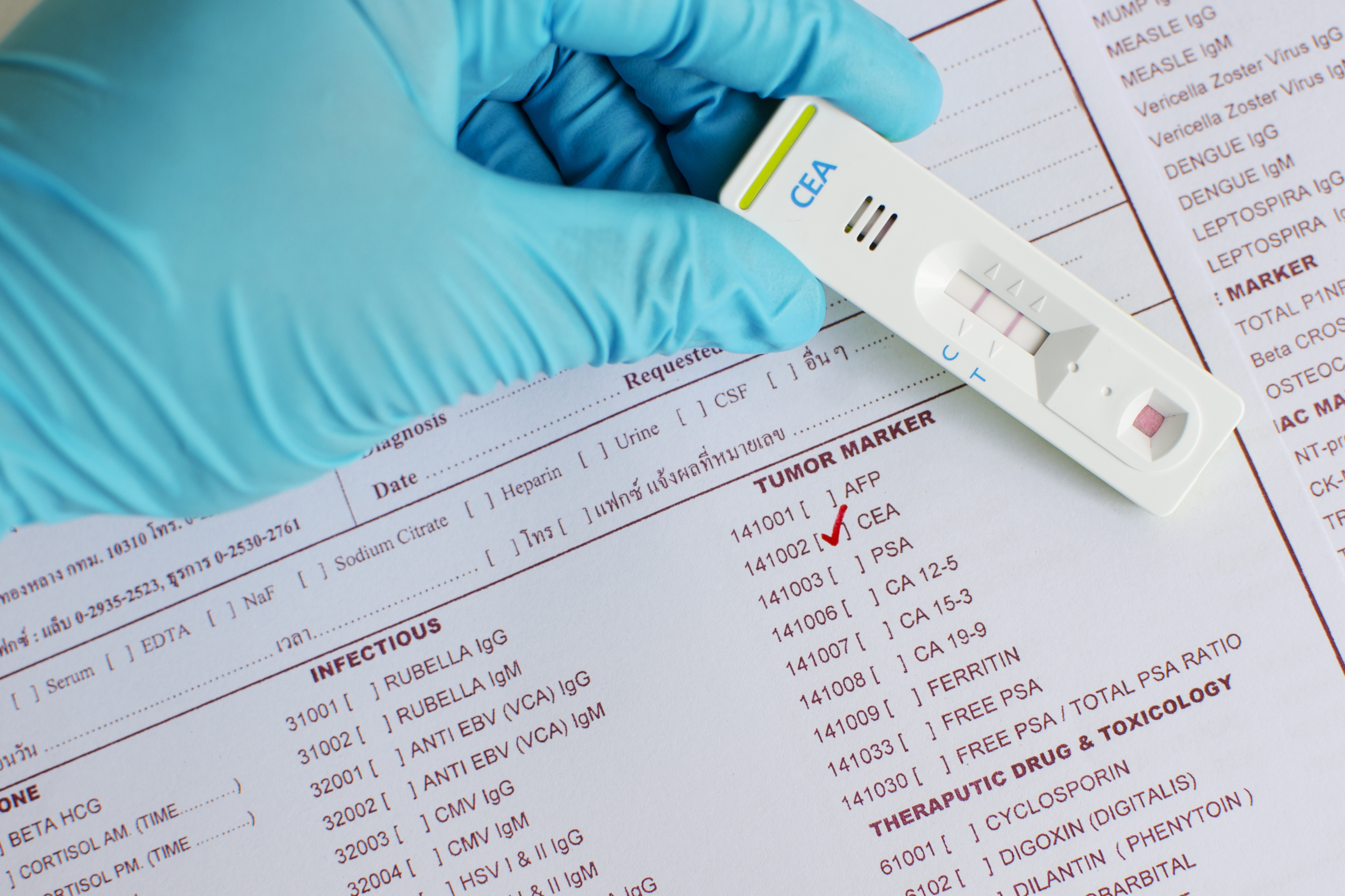 癌胚抗原对哪些癌症检查有价值？提醒超出这个数值要小心