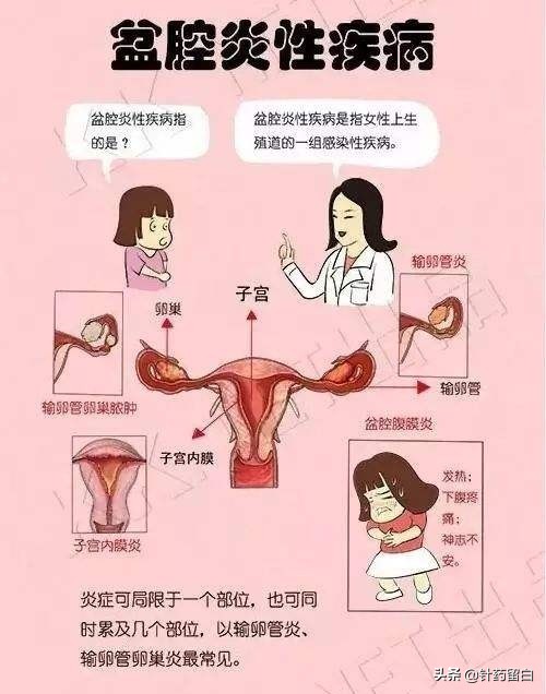 未婚女性盆底肌松弛漏尿怎么治疗,流产会导致盆底肌松弛漏尿吗