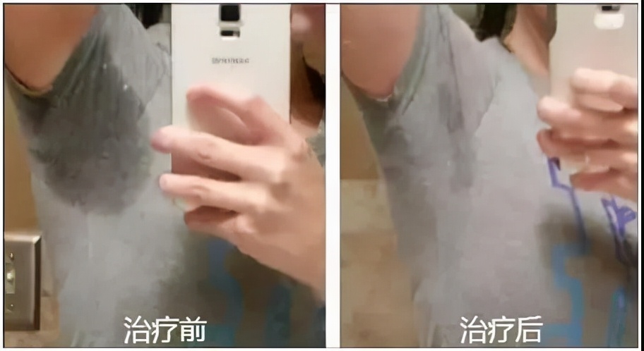 最让多汗人士尴尬的问题,一篇全解决