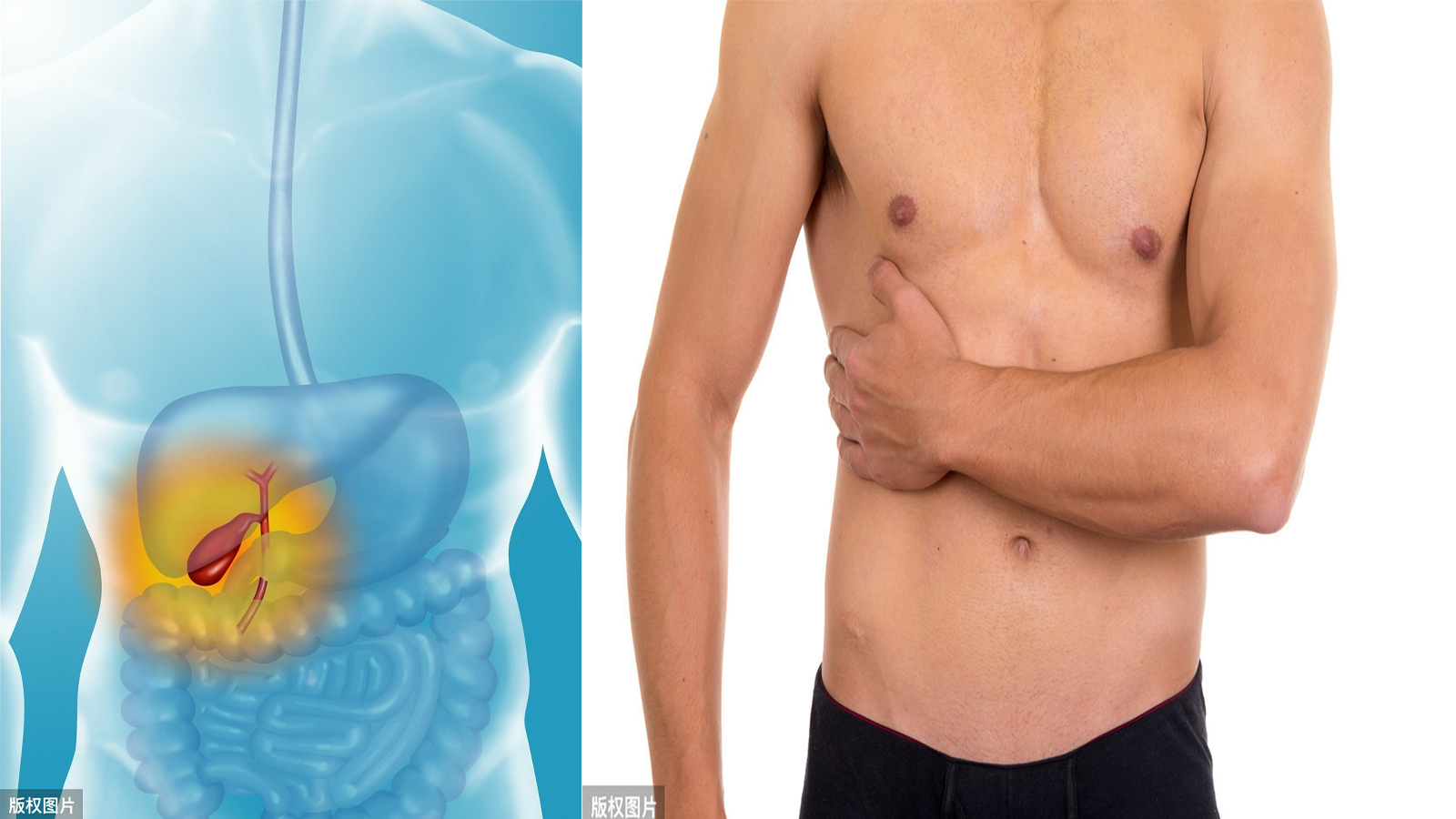 腹部隐痛警惕三种病,科普腹部的3种绞痛如何区分