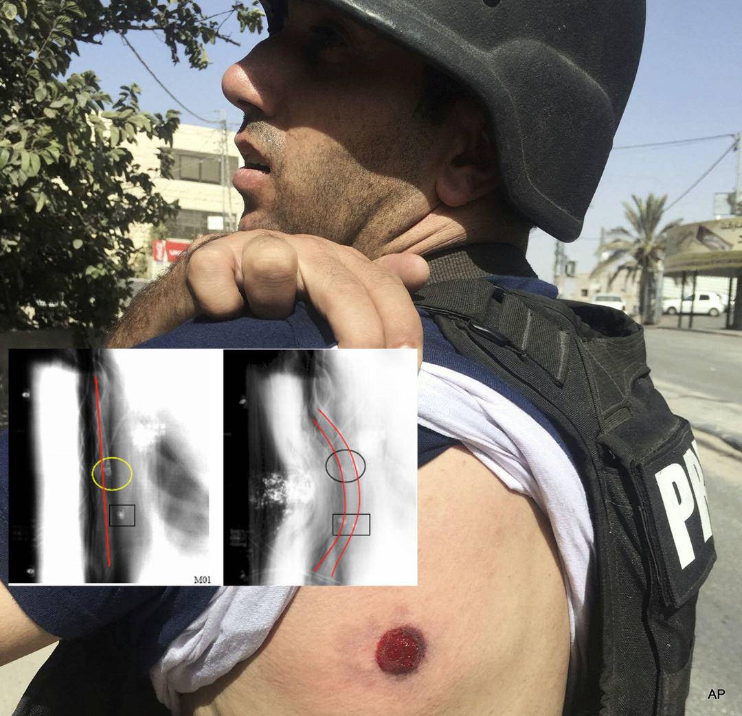 防弹衣会不会被炮弹炸下来,防弹衣能防原子弹吗