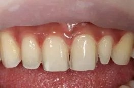 一白遮百丑可惜牙黄毁所有,一白遮百丑牙黄毁所有