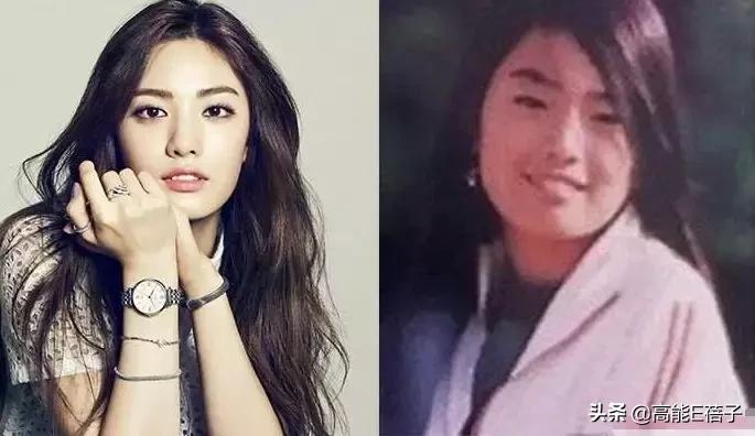 微整形需要多久,微整形后多久恢复正常