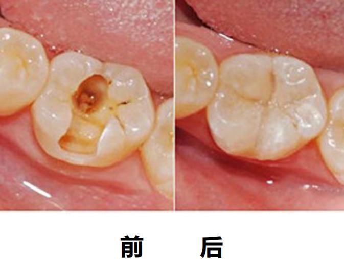 口腔门诊的十大优点,带你深入了解手术