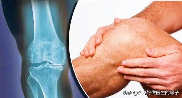 老年人天冷关节疼痛怎么缓解,老年人关节疼痛吃什么