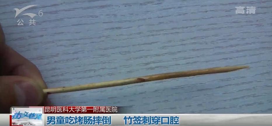 吃烤肠被竹签刺穿咽喉，医生：如果再刺深一点，孩子可能就当场死亡了