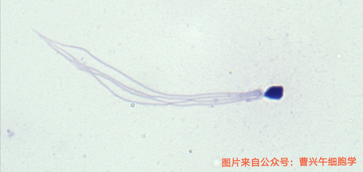 男科诊疗纪实,男科专家谈精子系列