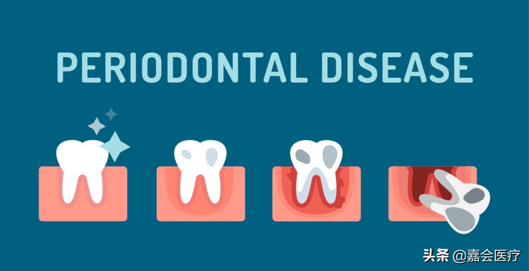 孕期牙疼最佳解决办法,孕期牙疼最好的缓解办法