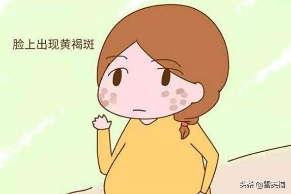 褐斑怎么除,褐斑怎么祛除最有效的方法