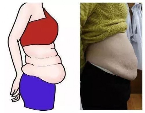 ECHAI智能康复运动仪，为您解决产后腹部松弛赘肉等问题