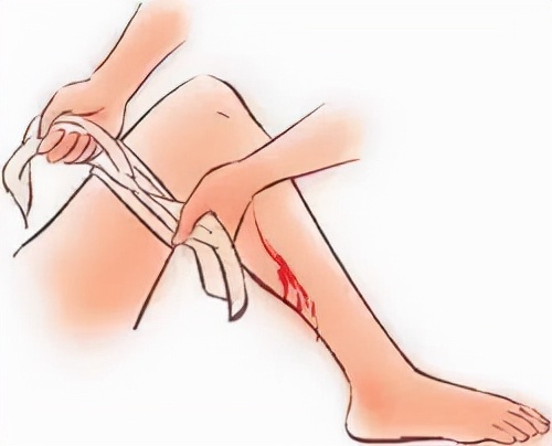 老人脑出血还有必要抢救吗,急救知识伤口少量出血怎么处理