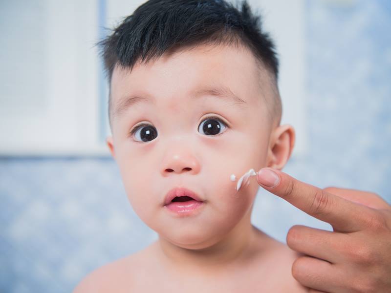 宝宝湿疹可以抹乳液吗,婴儿脸上湿疹可以涂乳液吗