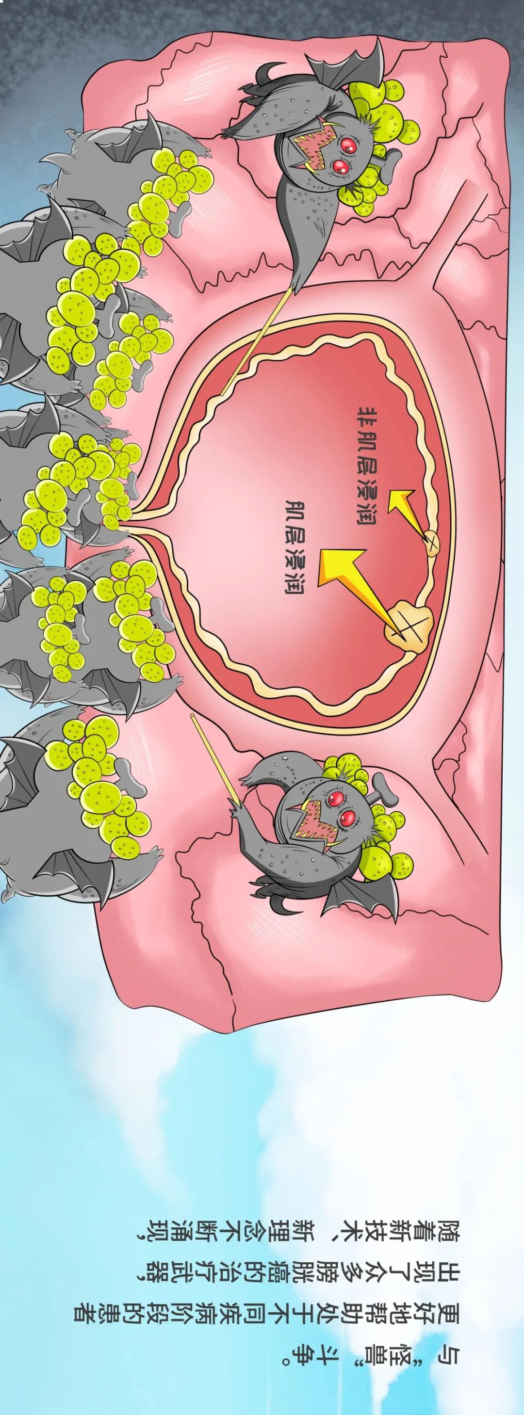 尿频尿急是不是肾炎,血尿尿频尿急会是泌尿系肿瘤吗
