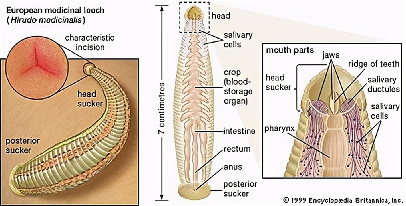 如果把水蛭吃进肚子会怎样,水蛭会不会寄生在身体里呢
