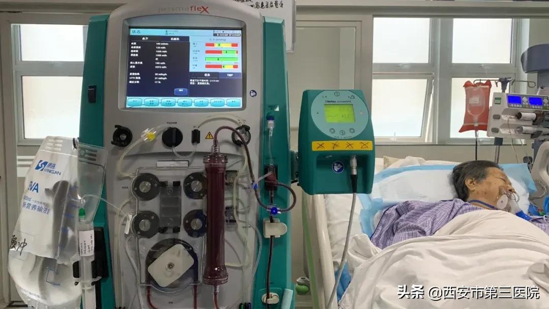 医学科普|ICU救命神器系列——CRRT