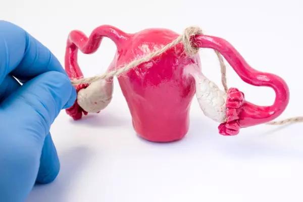 子宫诊刮是什么意思,诊刮能伤宫颈吗