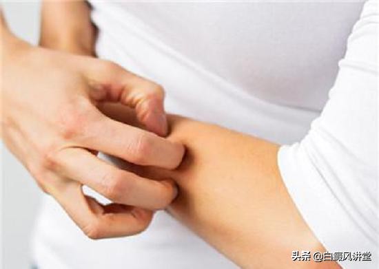 白癜风患处能抹防晒霜吗,白癜风的患处抹皮炎平吗