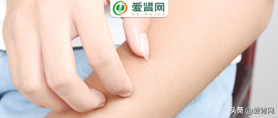 皮肤干燥发痒是尿毒症吗,尿毒症皮肤干燥掉皮瘙痒怎么缓解