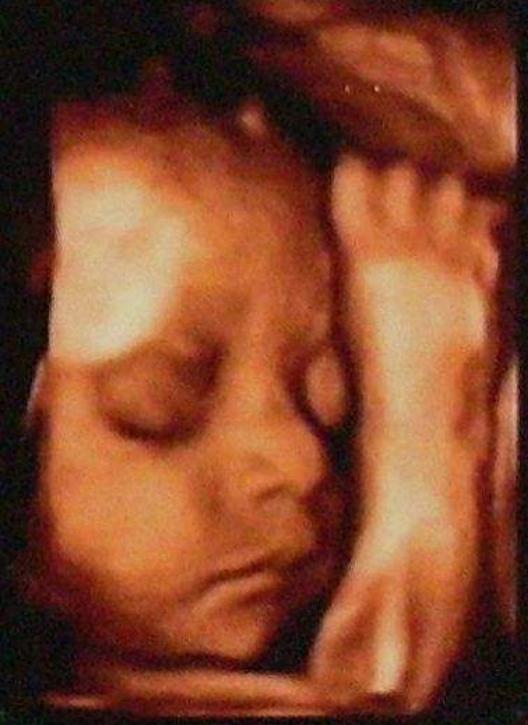 胎儿自然分娩有什么预兆,临产翻胎的正确方法