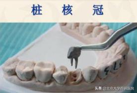 牙列缺损与牙体缺损,牙体缺失和牙列缺损区别