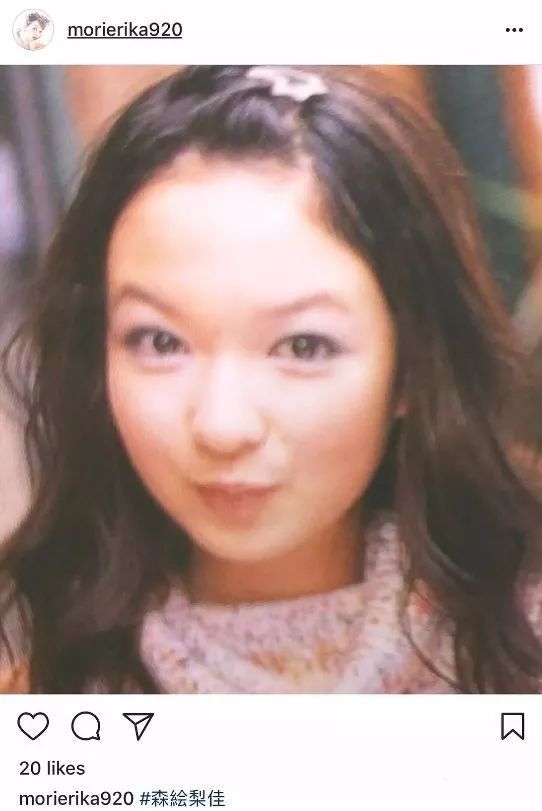 日本整容真的很好吗,日本整容vs韩国整容图片对比