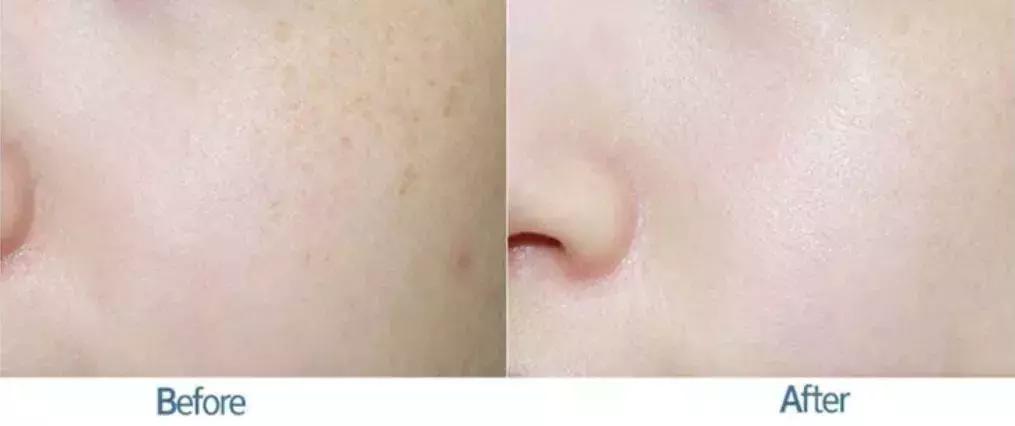 既能美白又抗老,既能美白又能抗衰老的护肤品