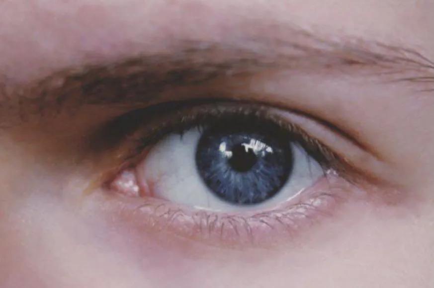 蓝眼隐藏了巨大的秘密,蓝眼睛的缺点