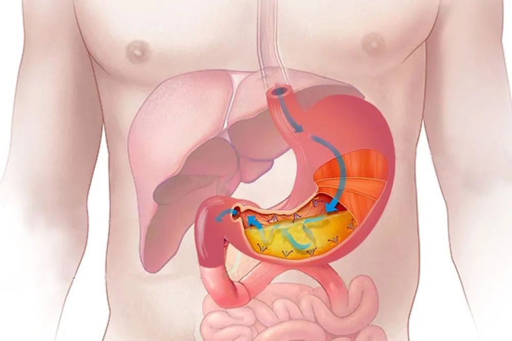 消化特别不好怎么治疗,消化不良怎么办这份良方请收藏