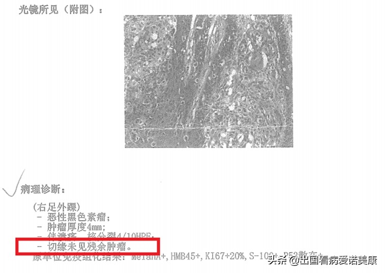 晚期癌症转移以及疗法,晚期癌症保守化疗