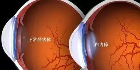 紫外线怎么杀蚊子,紫外线怎么杀真菌