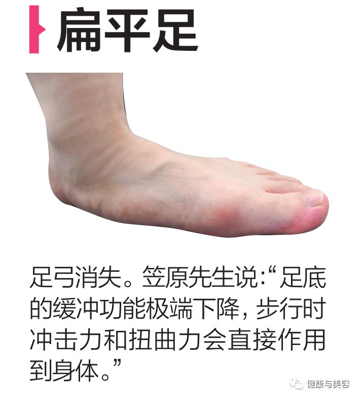 黄晓明谈身高被攻击,黄晓明的脚是如何康复的