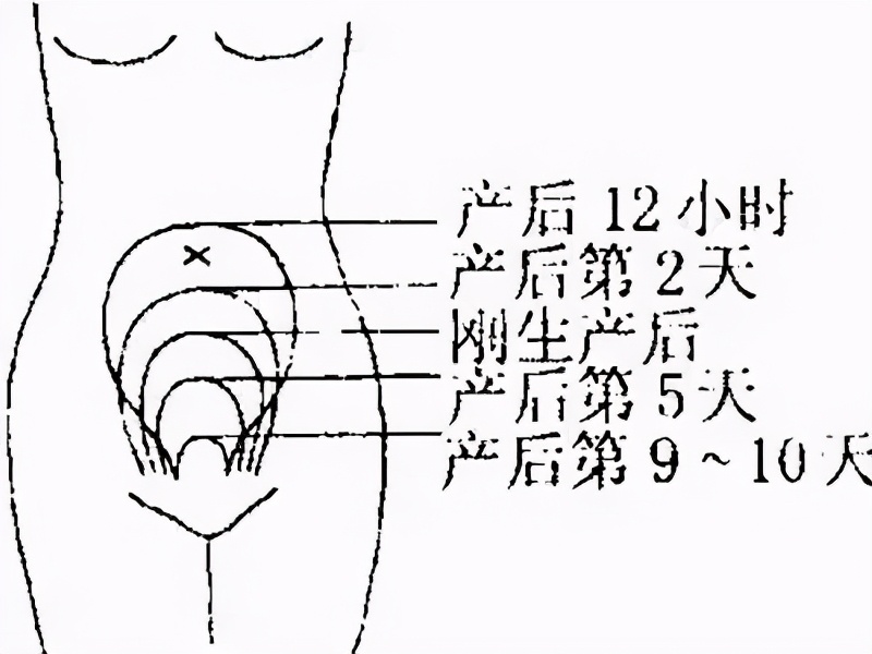 产后保健和护理事项须知