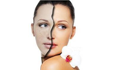 黑色素如何炼成的,黑色素怎么生成详细解说