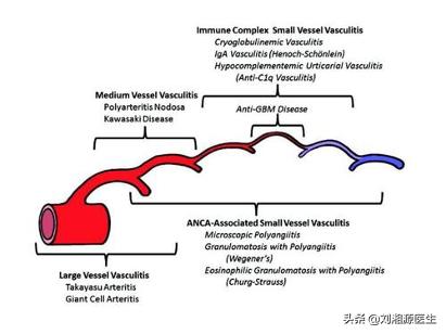 系统性血管炎怀孕能要吗,怀孕得了血管炎怎么办