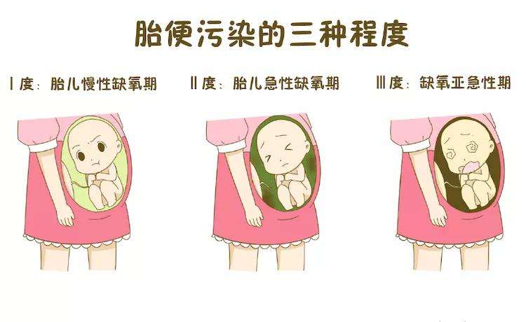 新生儿手脚起皮怎么处理,手脚皮肤干燥皲裂