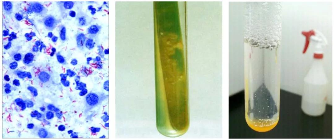 结核诊断方法和防治原则,结核的病原学诊断
