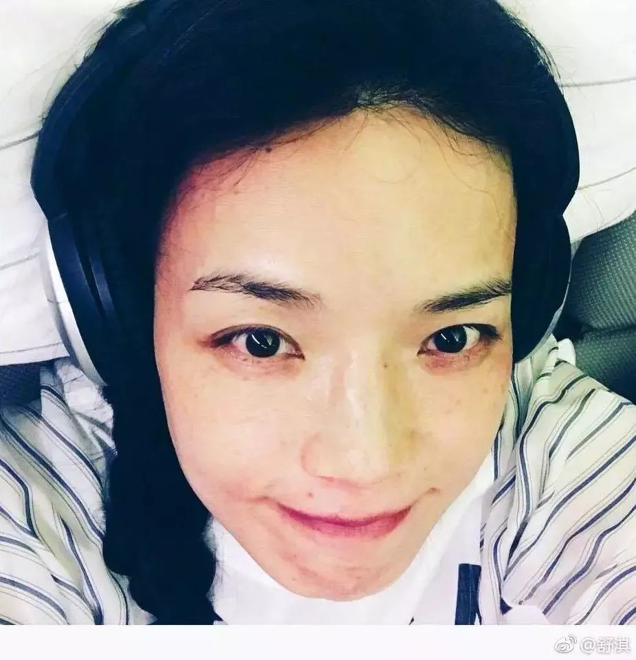 女明星皮肤过敏,女明星过敏发作