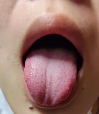 璋﹀窛涓尰,鏉窞璋﹀窛涓尰