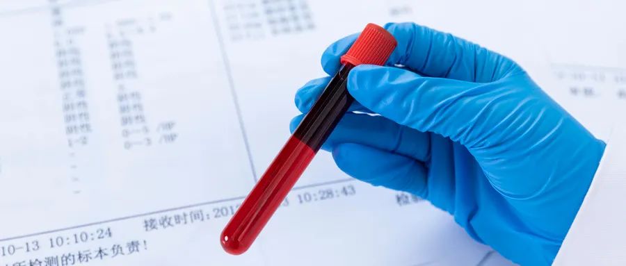 超敏c反应蛋白112严重吗,超敏c反应蛋白50什么意思