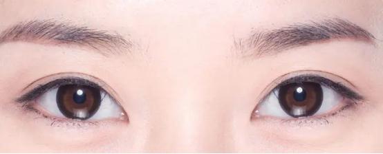 平扇形型双眼皮适合什么脸型,新月型双眼皮适合什么脸型的人