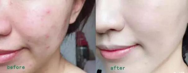 韩斯清把pony给迷住了！李佳琦+小P老师也上瘾，不愧是鼻祖级BB霜