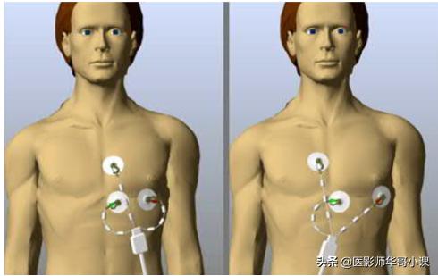 心脏mr增强扫描讲解,磁共振心脏扫描标准切面