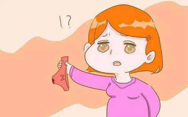 妇科阴道出血常见症状,阴道流血有什么症状表现