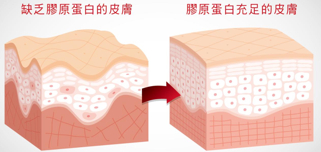 法令纹真的难看吗？奥黛丽赫本的法令纹这么迷人！你也可以做到