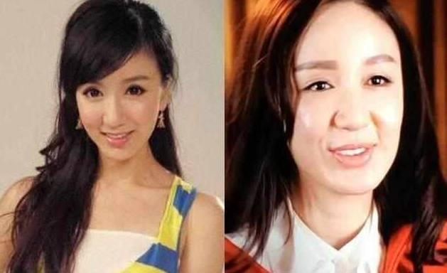 打玻尿酸和瘦脸针有什么后遗症,瘦脸针玻尿酸危害