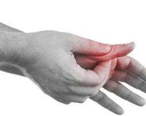 非布司他片的功效及副作用痛风,非布司他痛风药效