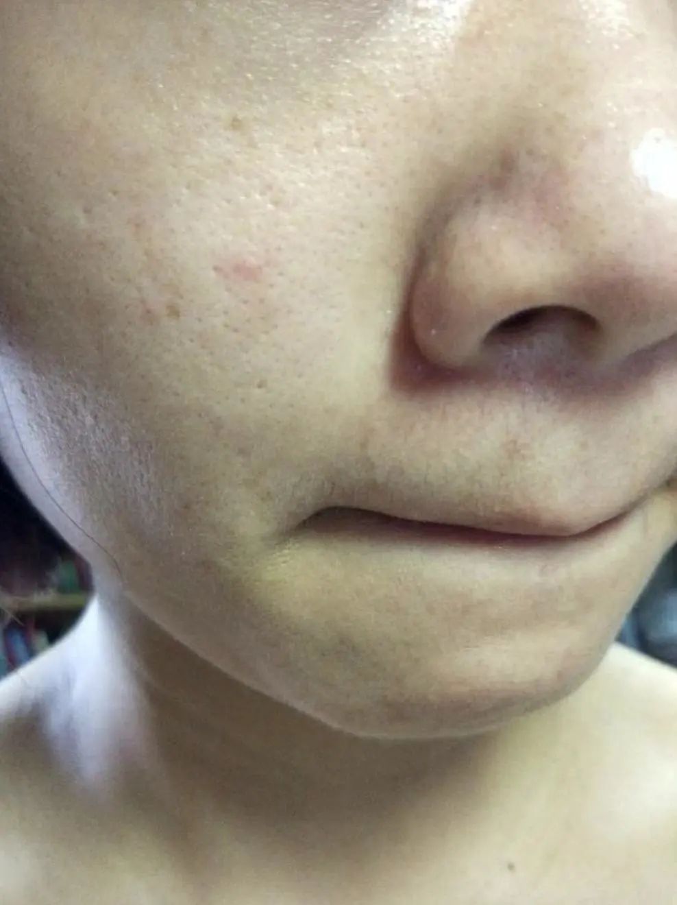 护肤达人分享经验,15年护肤达人分享