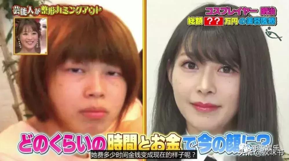 整容脸vs自然脸同龄女星对比,明明是整容脸却没被吐槽过