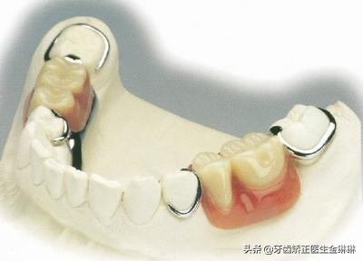 为什么做假牙就牙痛,镶牙几年后假牙下的真牙疼怎么办