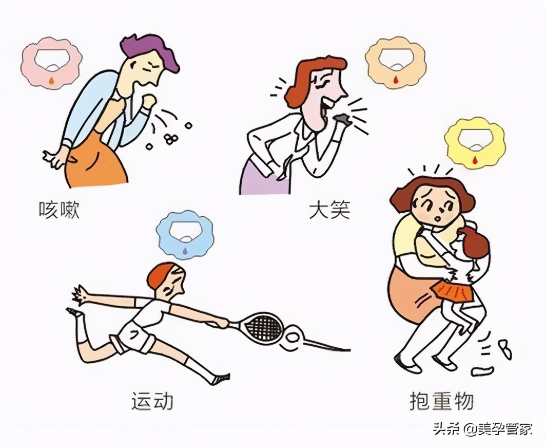 顺产剖腹产哪种对盆底伤害大,顺产和剖腹产哪个盆底肌损伤大